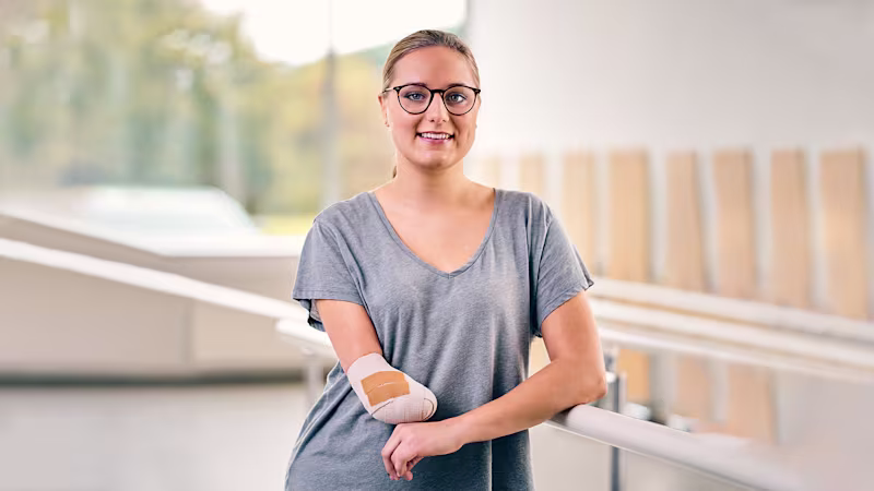 An amputee poses happily