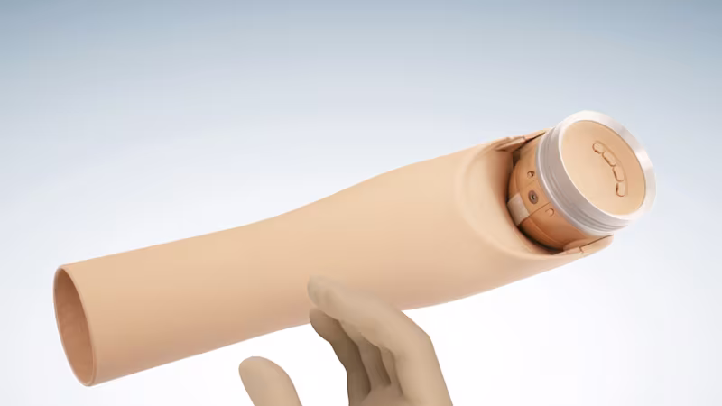 Prosthetic hands and arms for performance-driven users - Prosthetic arm options - Value combination (AU)