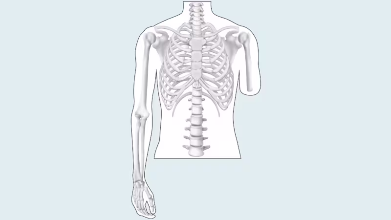 amputation level upper limb drawing 16 9 content