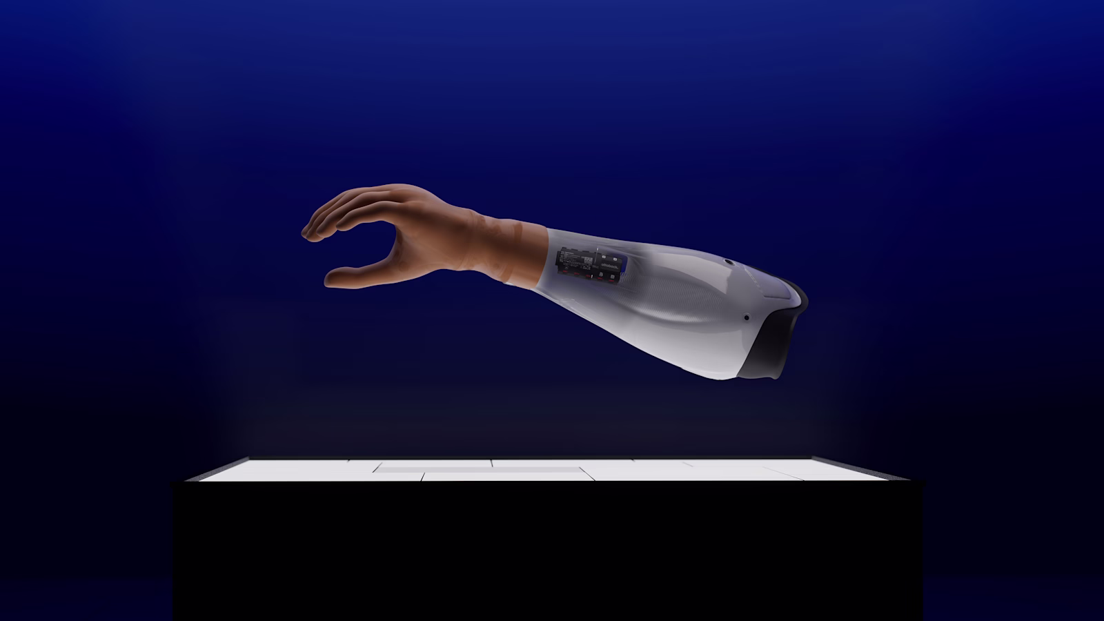 Ottobock speedhand solution