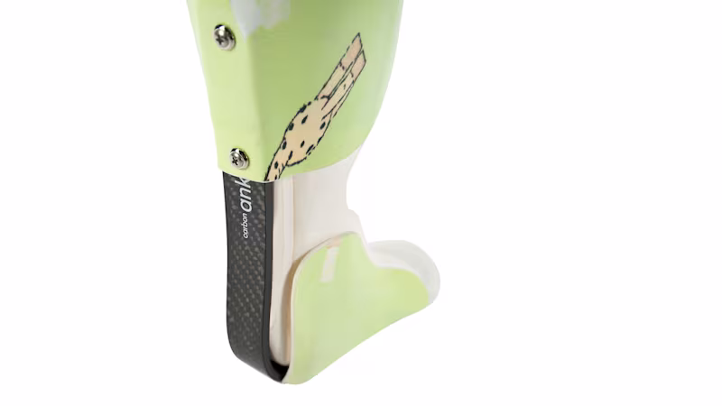 17CF1 feature2 o_JA-JP