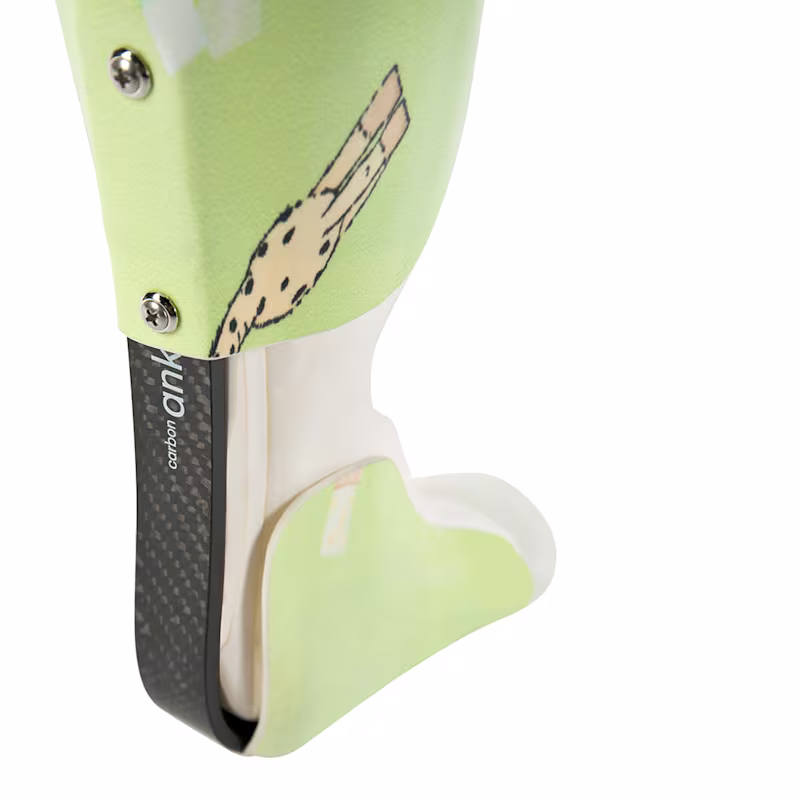 17CF1 feature2 o_JA-JP