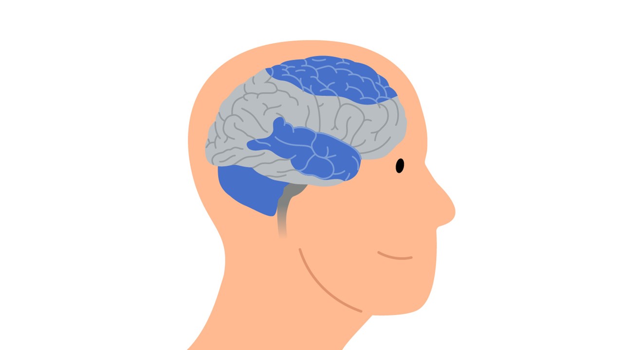 CP Awareness Month - Types and Symptoms of Cerebral Palsy - Mixed Cerebral Palsy (HQ)