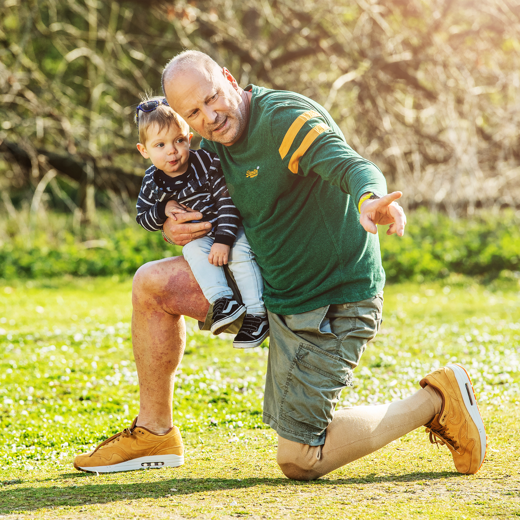Axel kneels with his Genium Microprocessor Knee while holding a child and pointing out something in the distance.