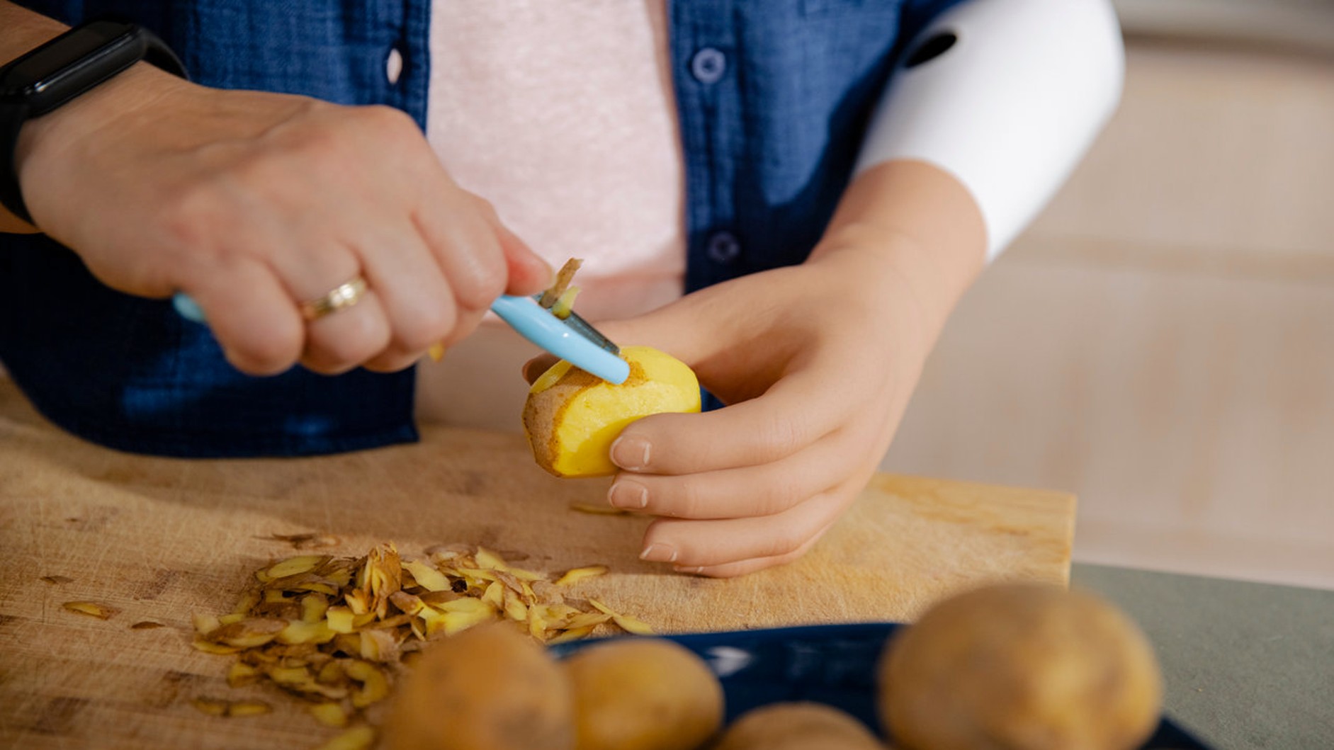 A woman wearing an Ottobock speedhand with a realistic hand cover peeling potatoes in her kitchen