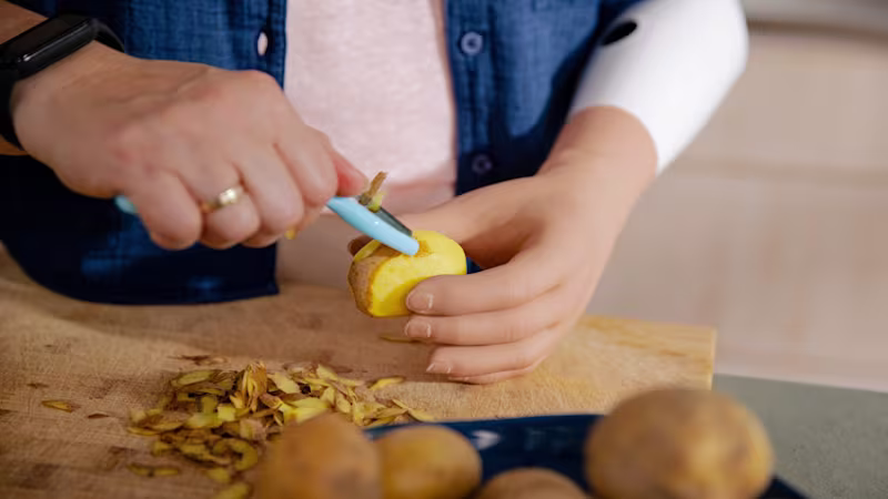 A woman wearing an Ottobock speedhand with a realistic hand cover peeling potatoes in her kitchen