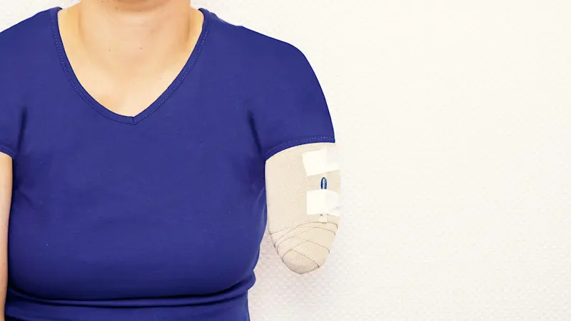 An amputee in a blue t-shirt with their residual limb bandaged