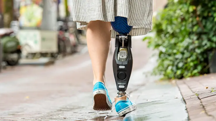 The prosthetic foot makes a difference for your fitting success