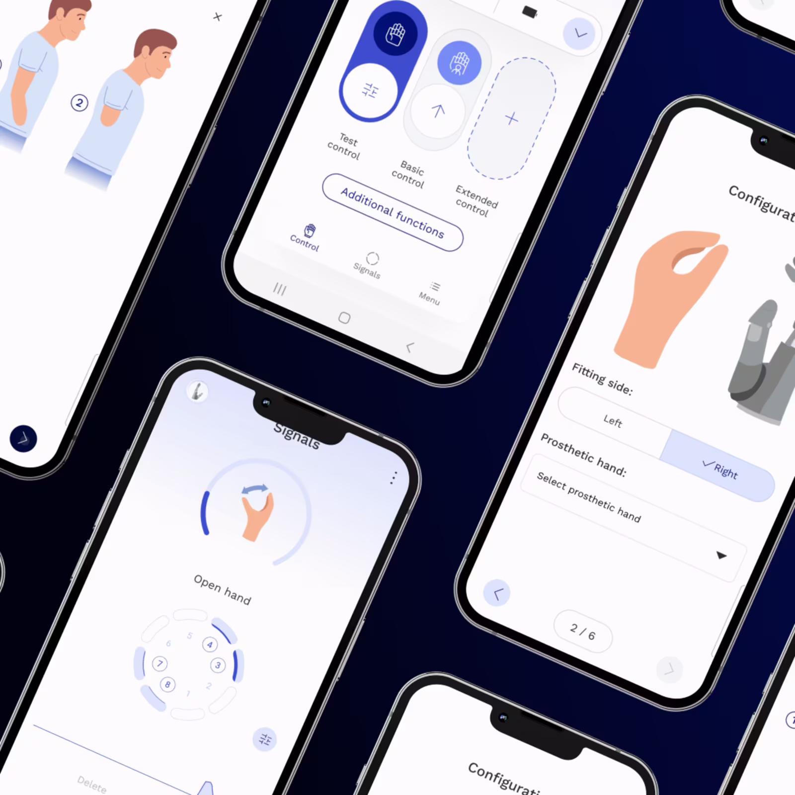 Bildschirme der connectgrip-App-Oberfläche zur Anpassung von MyoBock-Komponenten von Ottobock, mit verschiedenen Steuerungs- und Anpassungsoptionen.