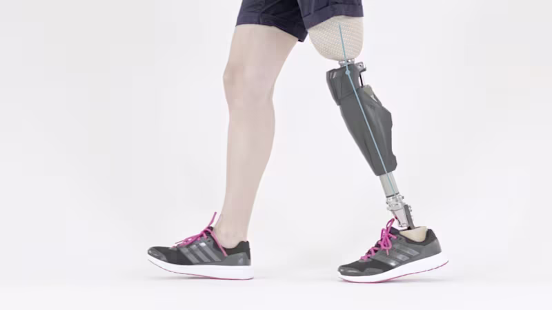 FirstSpiritExport,OBISCM-1557,web_site,prosthetics_2,lower_limb_1,mpk_know_the_difference,opg