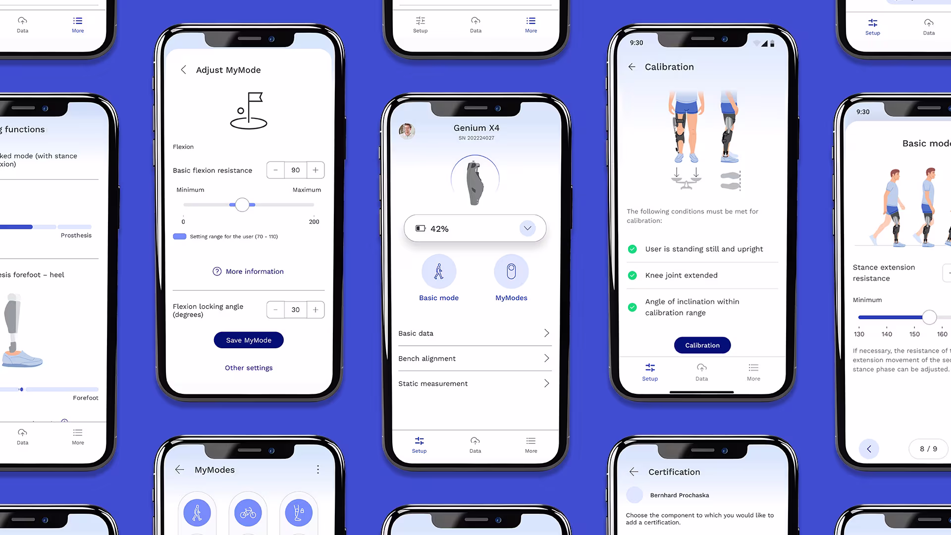 A screenshot of the app showing a TF prosthesis in bench alignment.