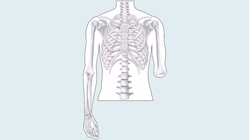 amputation level upper limb drawing 16 9 content-5