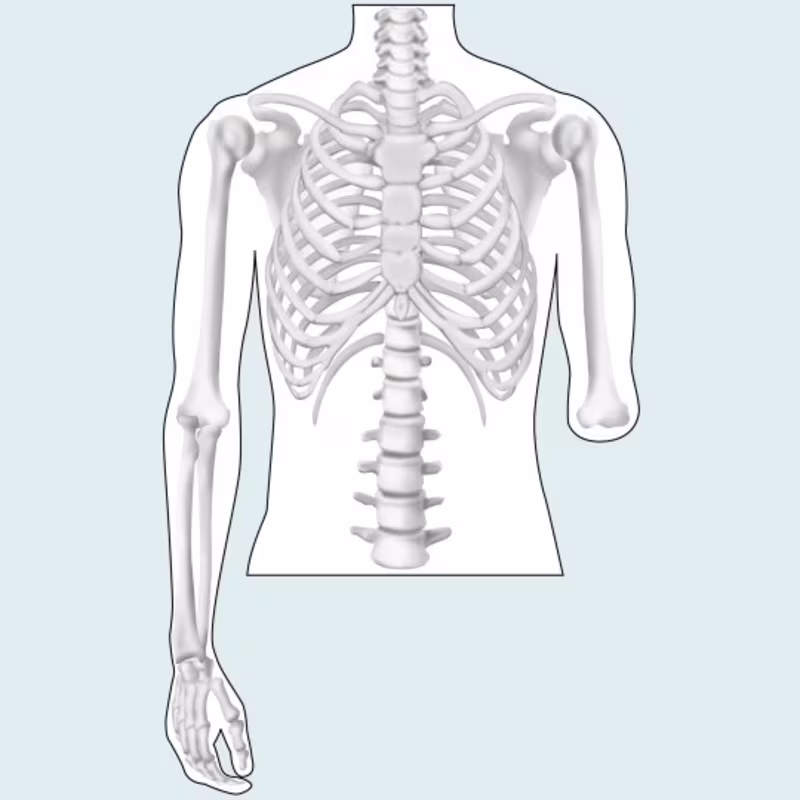 amputation level upper limb drawing 16 9 content-5