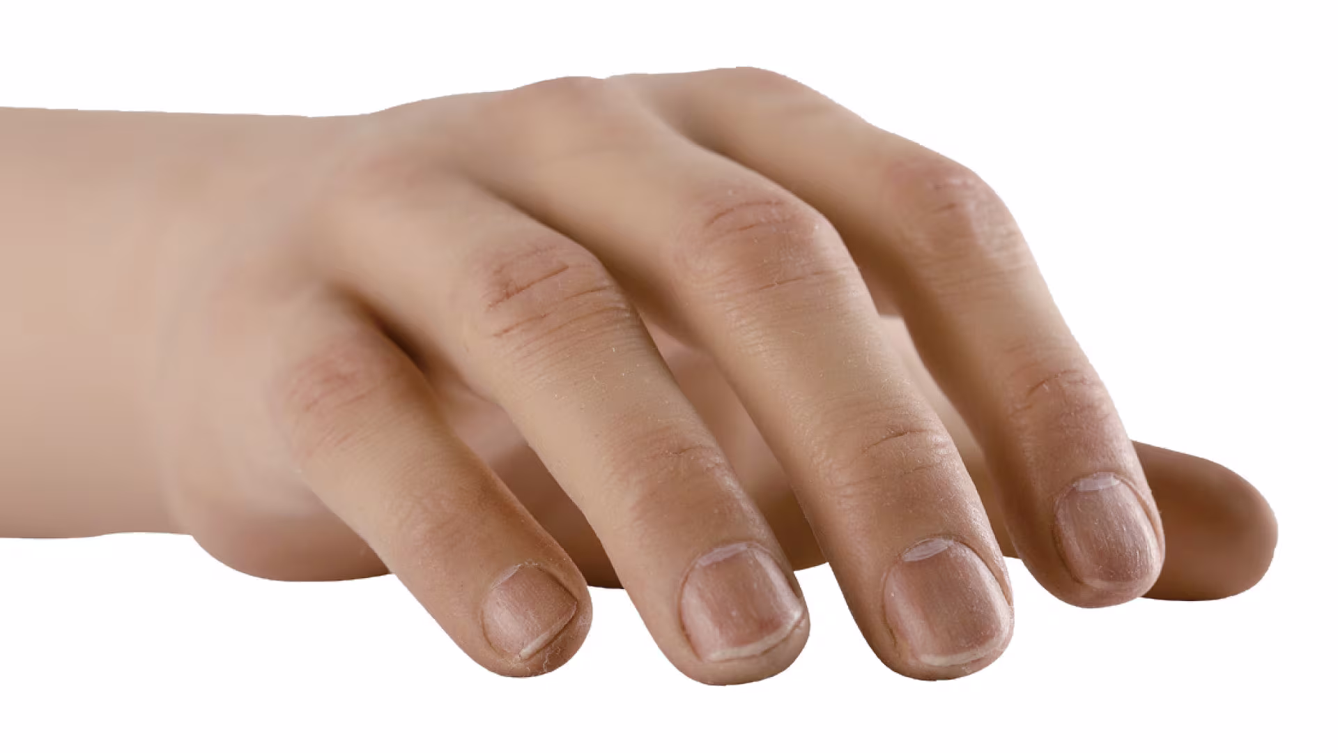 FirstSpiritExport,OBISCM-1557,web_site,prosthetics_2,upper_limb_1,michelangelo