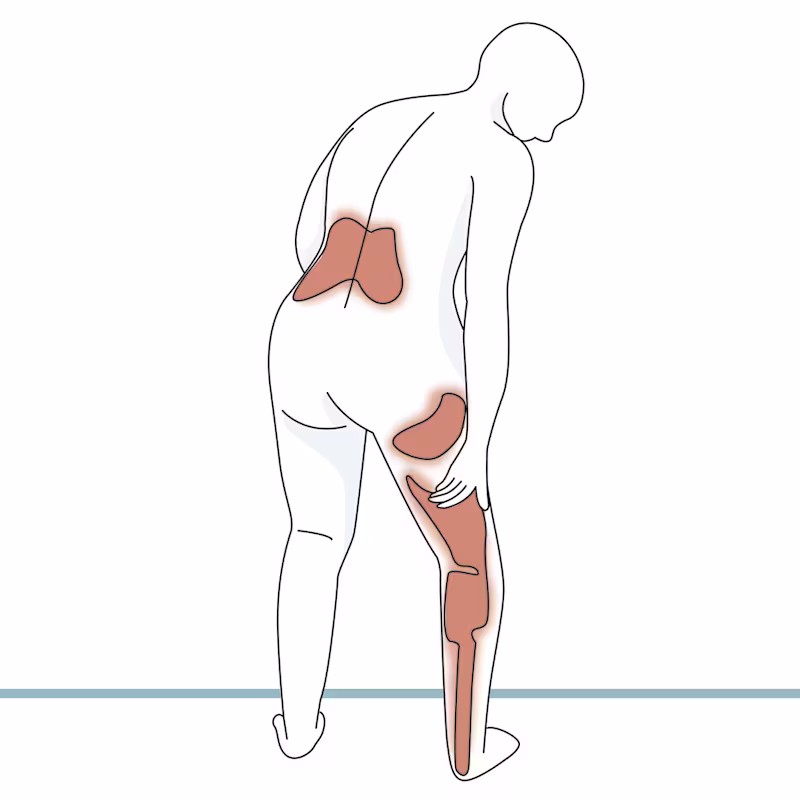 FirstSpiritExport,OBISCM-1557,web_site,orthotics_2