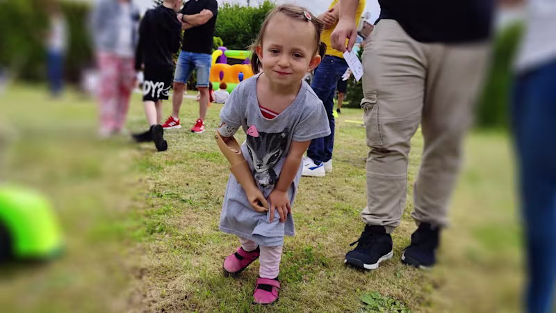 Verunka-2400x1344-3-amputace-hk-u-deti