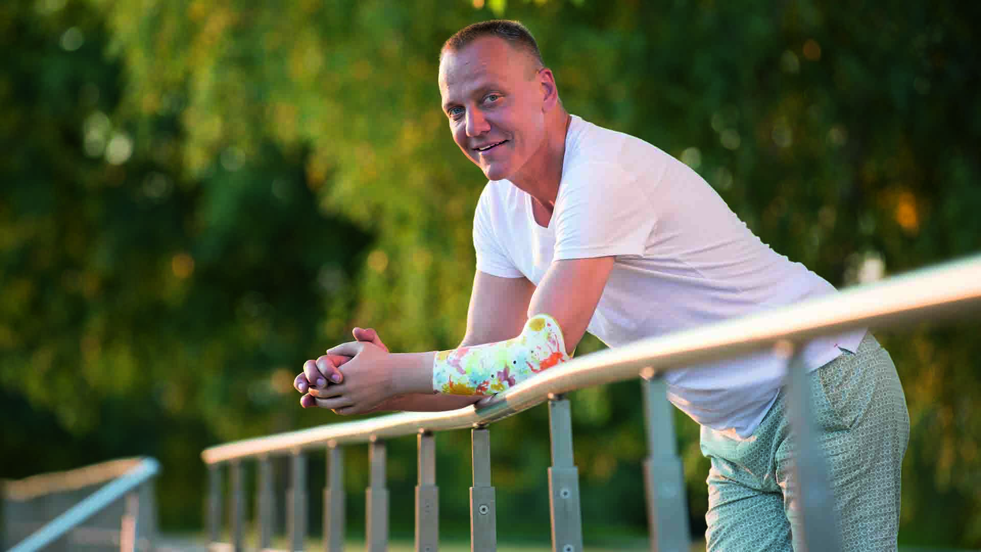 A man wearing a flexible prosthetic arm socket with a custom pattern leaning on a railing