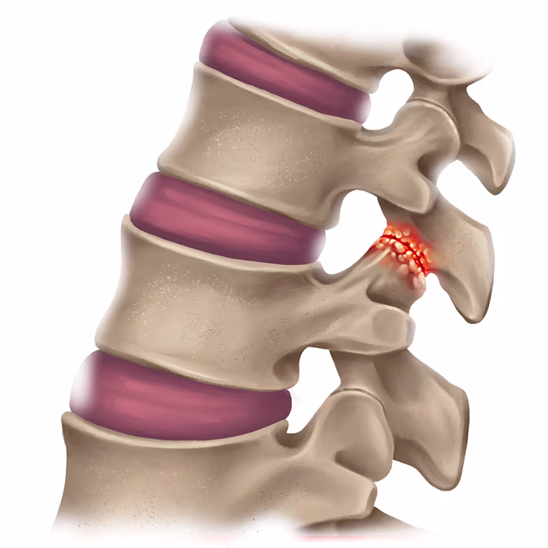 2756457--11-col(2759295) en