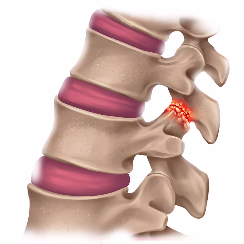 Dettaglio per mal di schiena