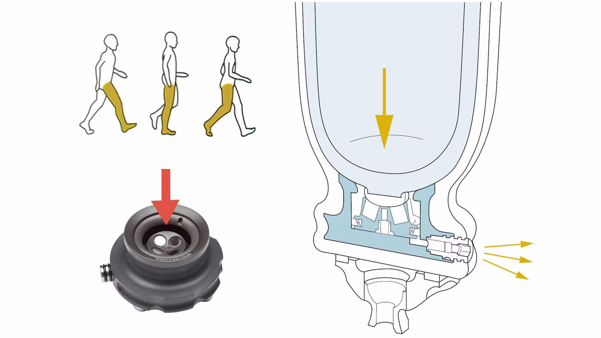 義足懸垂システム 4R220ダイナミックバキュームDVS 下腿義足