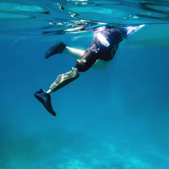 FirstSpiritExport,OBISCM-COM,OB_ISCM_COM_export,media,media,ottobock_corporate,press,2019_02_08_100_jahre_ottobock