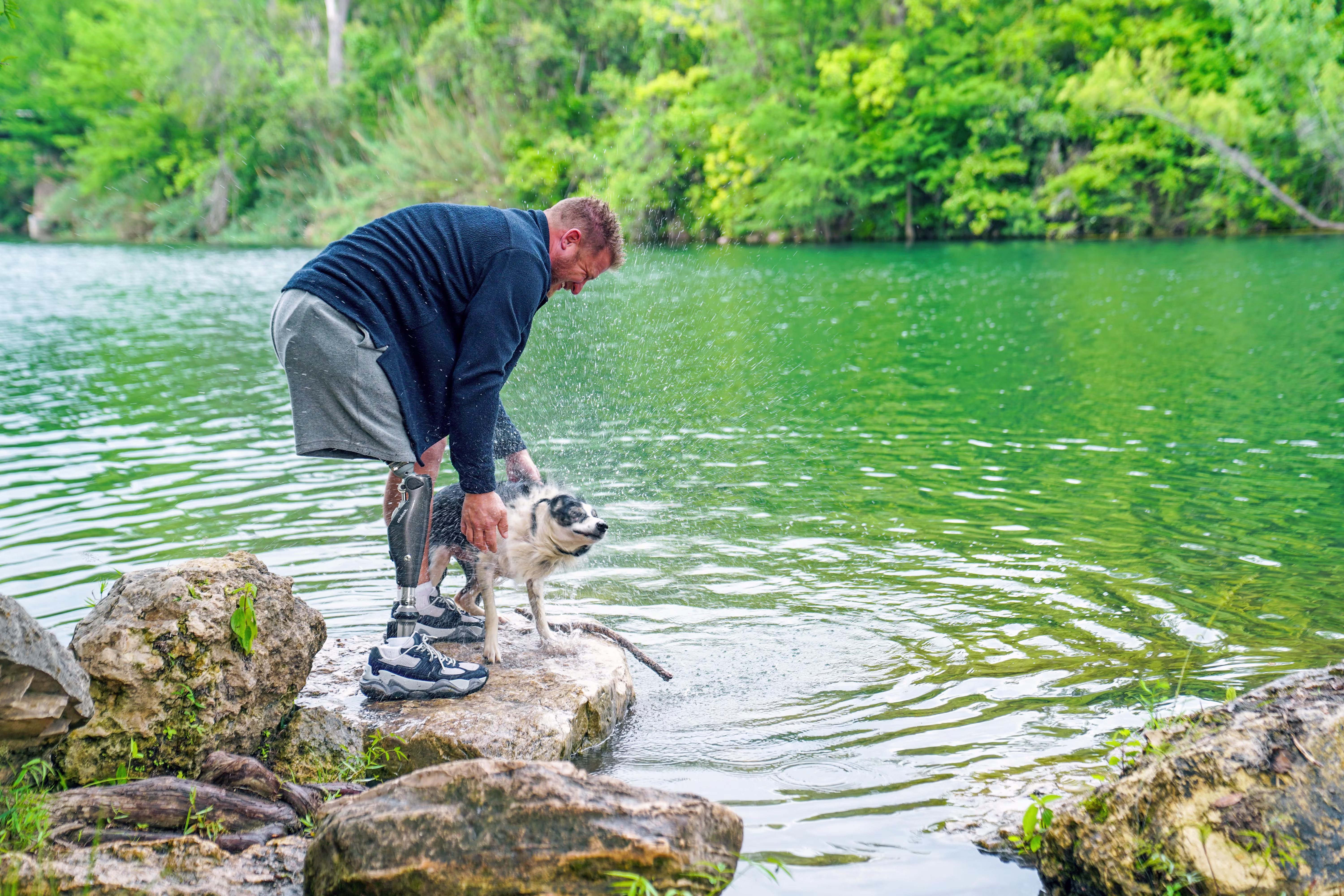 An Ottobock C-Leg 4 user being outdoors by a lake with his dog.