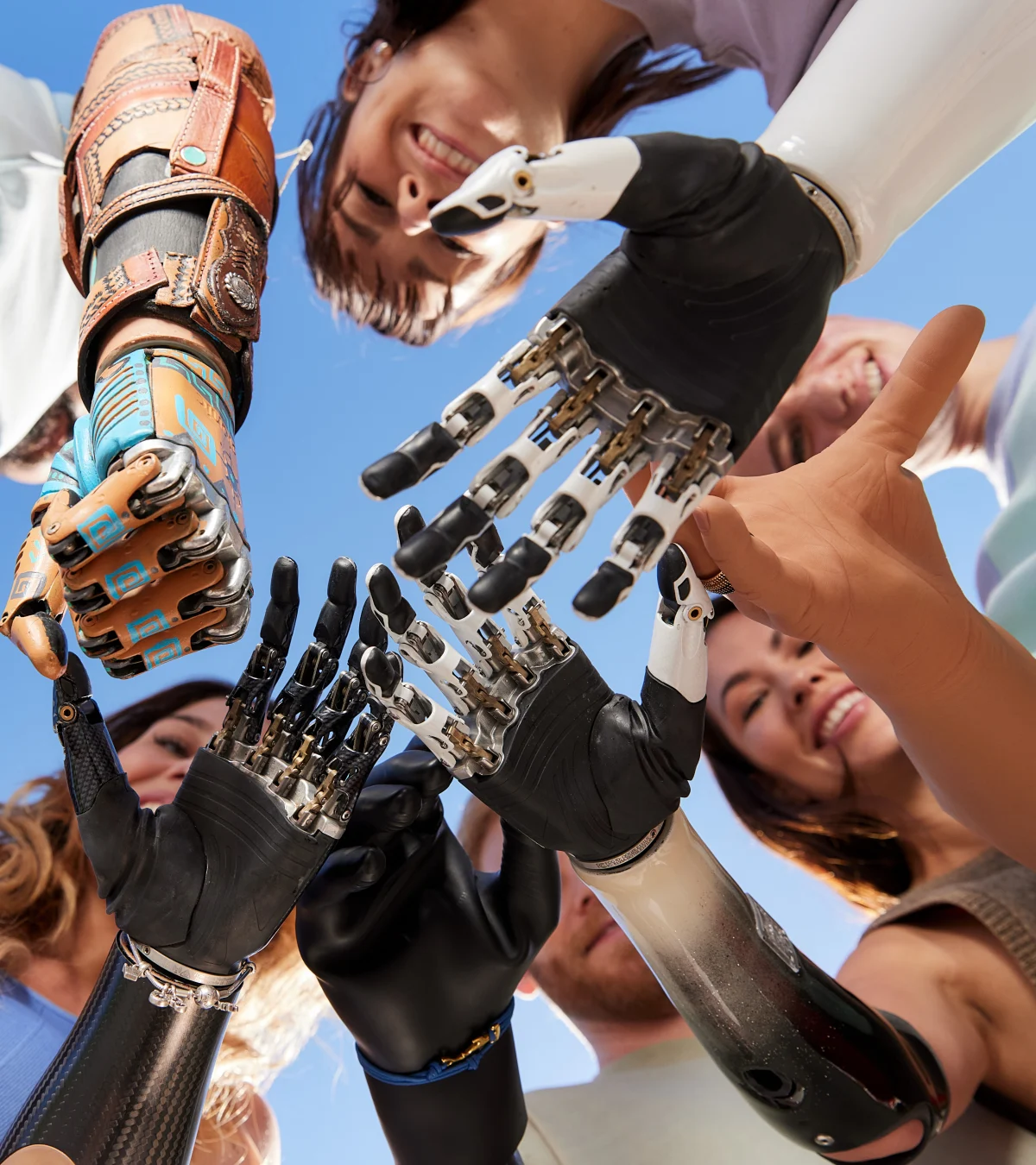 Hand Prosthetic Using Spring's Ottobock | NHS multi-grip prosthetic hand policy