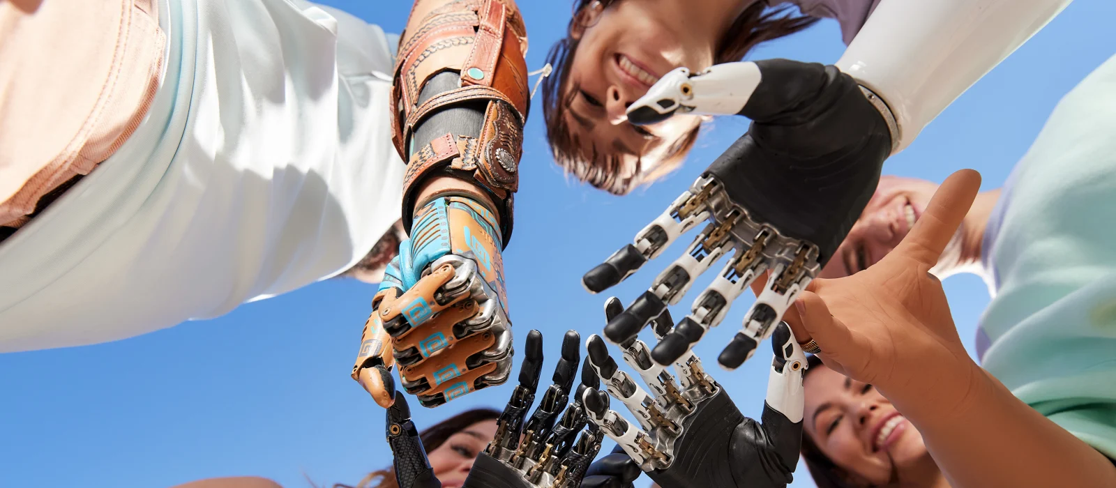 Mult-Grip Prosthetic Hands from Ottobock available on the NHS