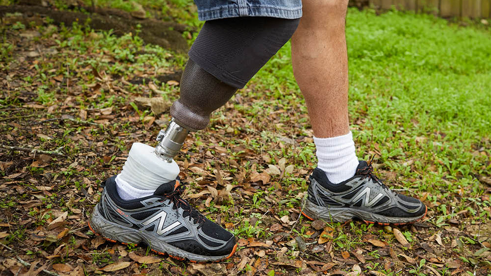 義足 コンピューター制御足部 Meridiumメリディウム