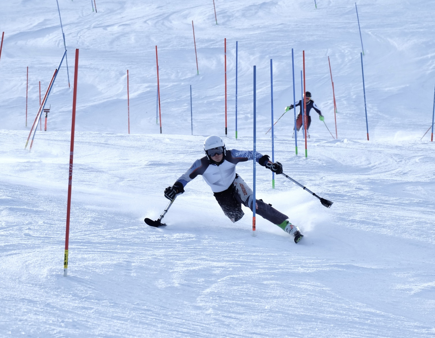 (c) ottobock I Christoph Gloetzner 