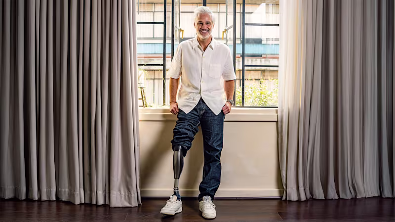 A man with a prosthetic leg stands in front of a window.
