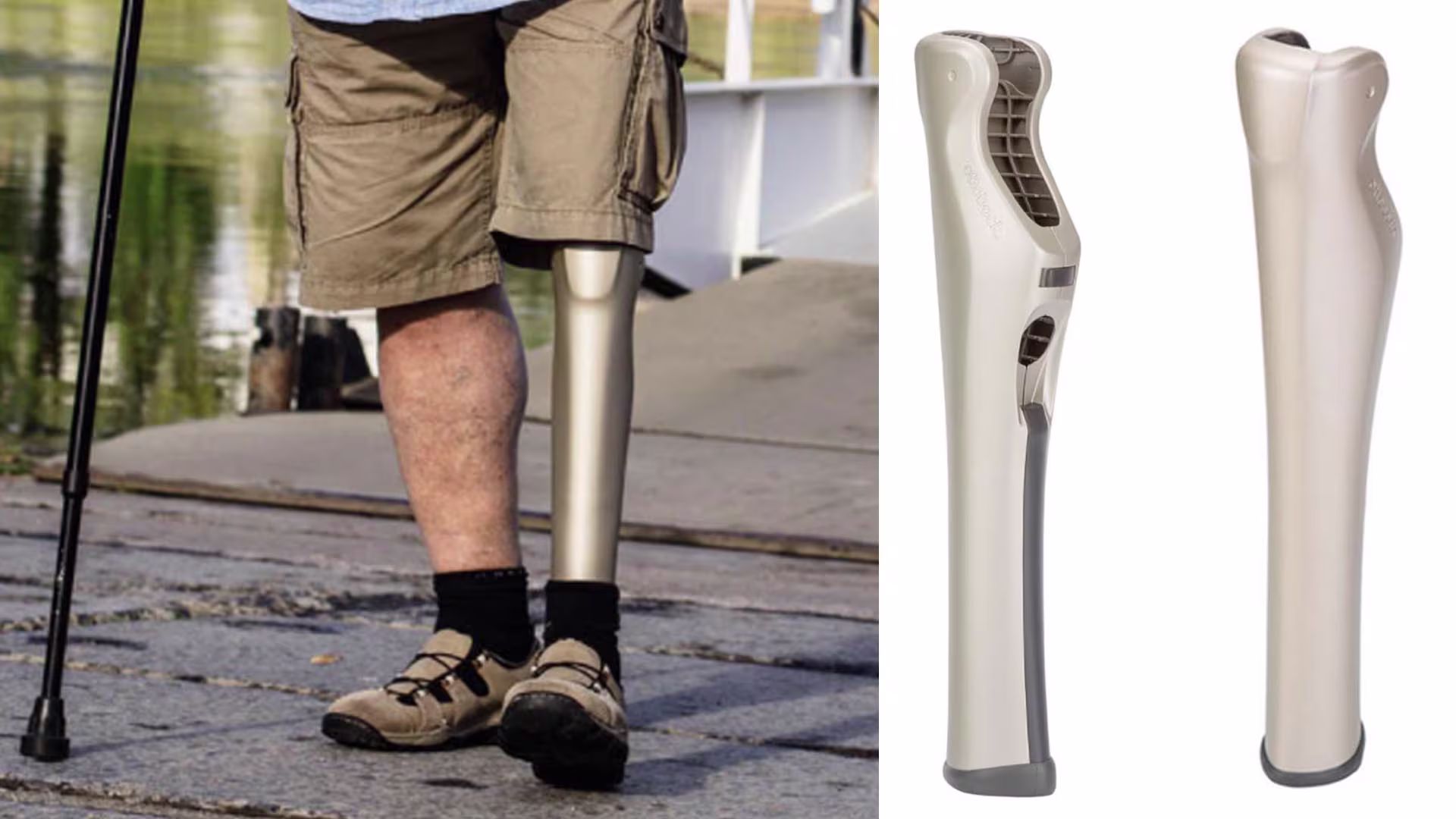 義足 コンピューター制御膝継手 Kenevo 4X840 プロテクター