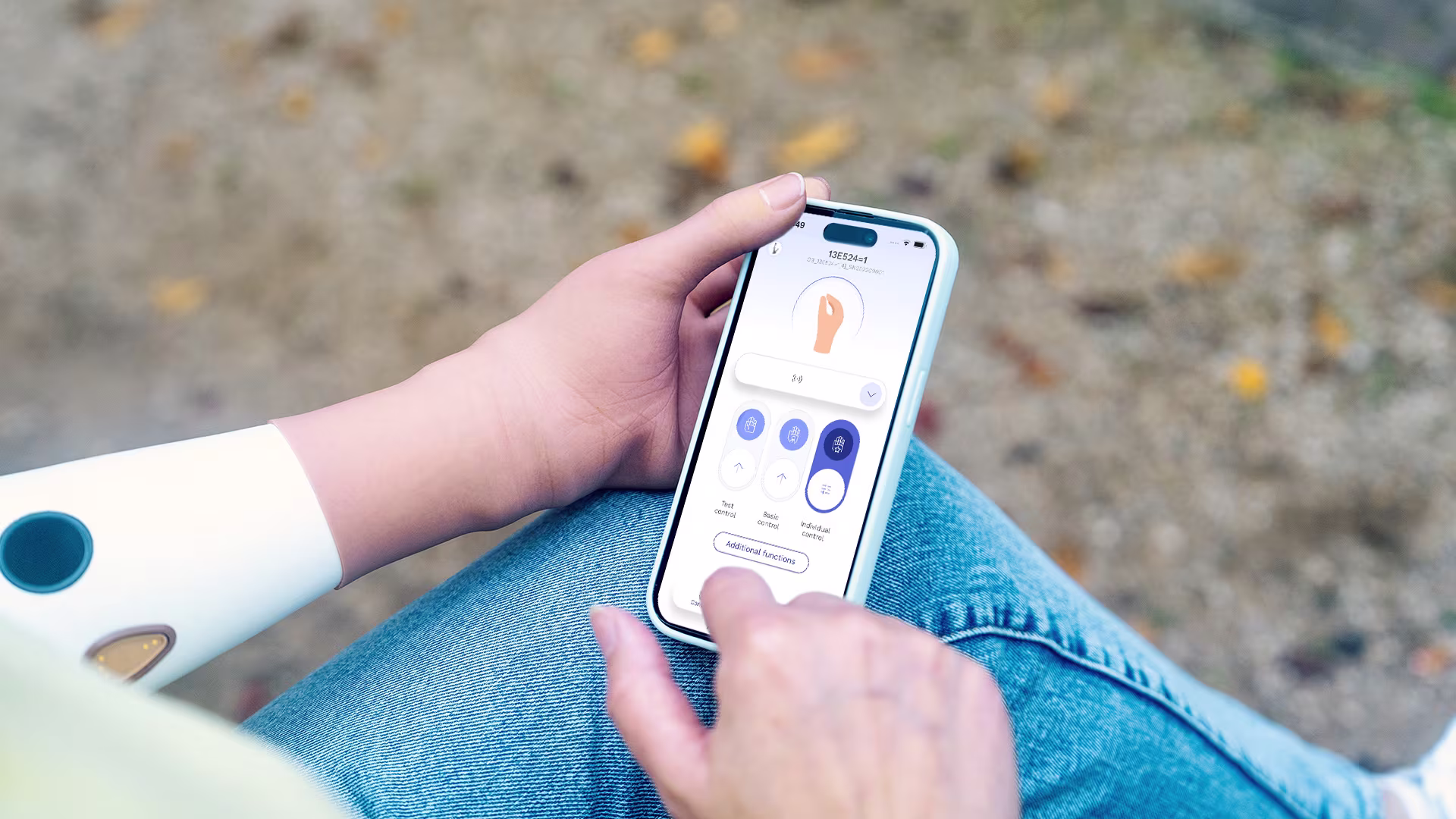 Close-up of the speedhand myoelectric prosthetic hand while using a smartphone.