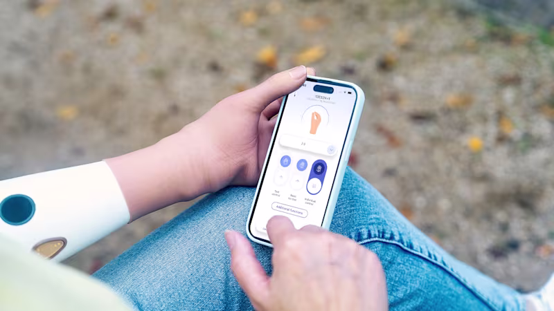 Close-up of the speedhand myoelectric prosthetic hand while using a smartphone.