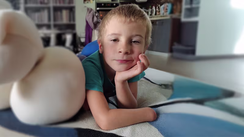 Peta-2400x1344-2-amputace-hk-u-deti