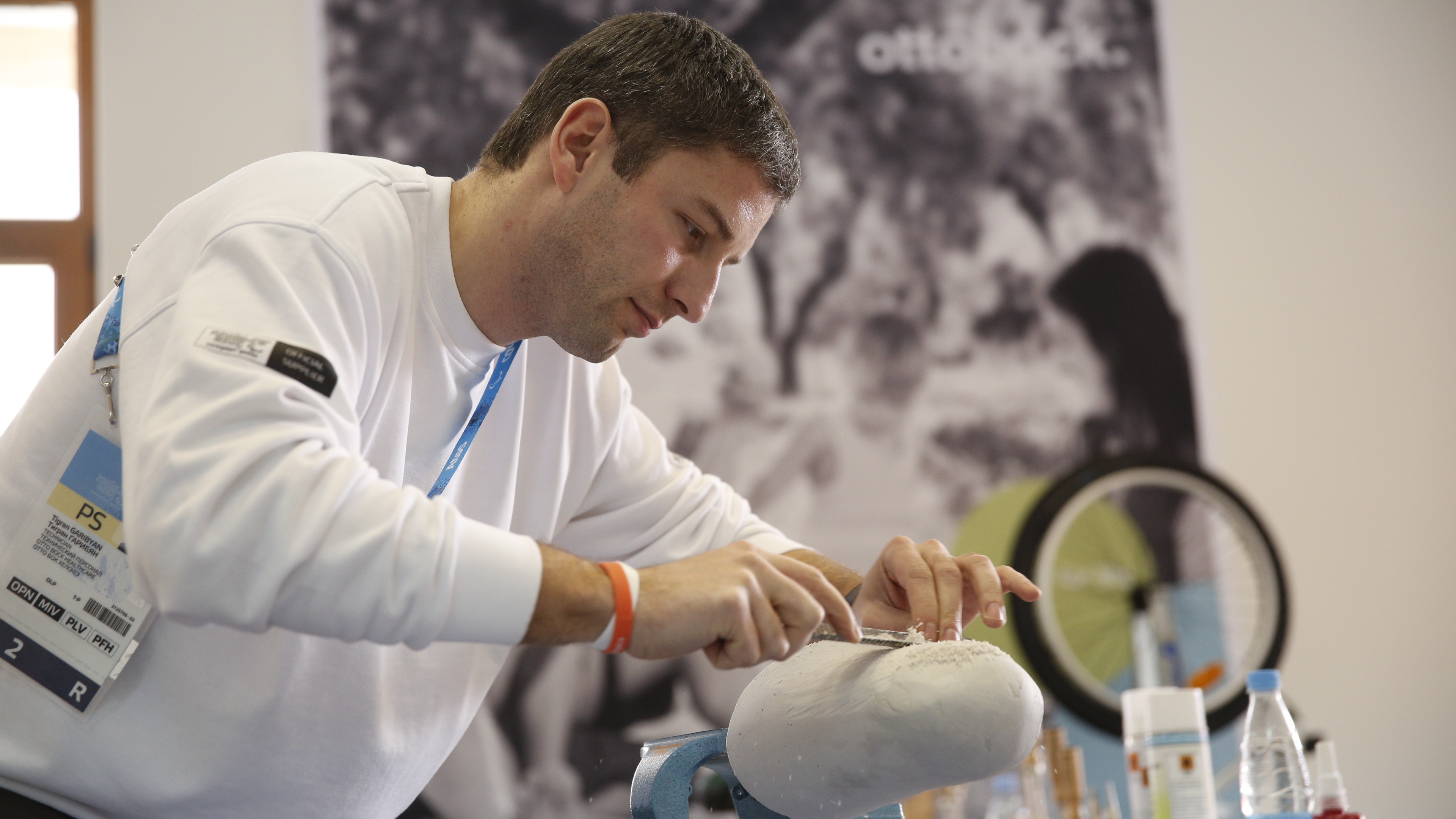 Техник-протезист обрабатывает слепок для изготовления культеприемной гильзы протеза.