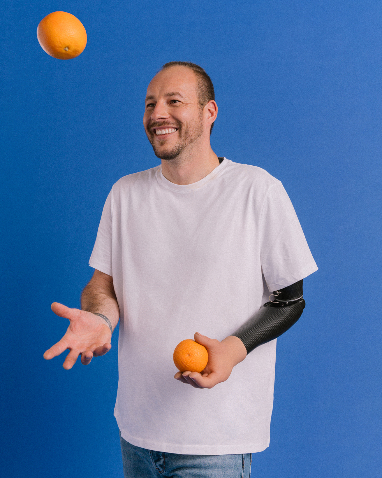 Ottobock NHS multigrip prosthetic hand policy