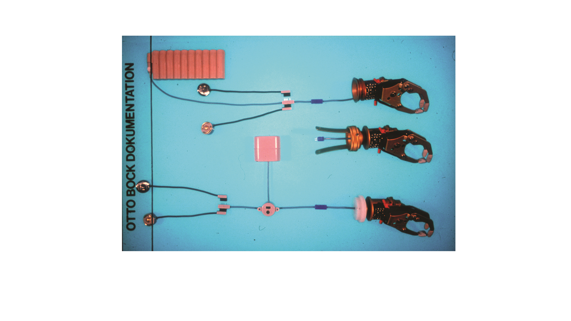 筋電義手 マイオボックシステム 開発の歴史