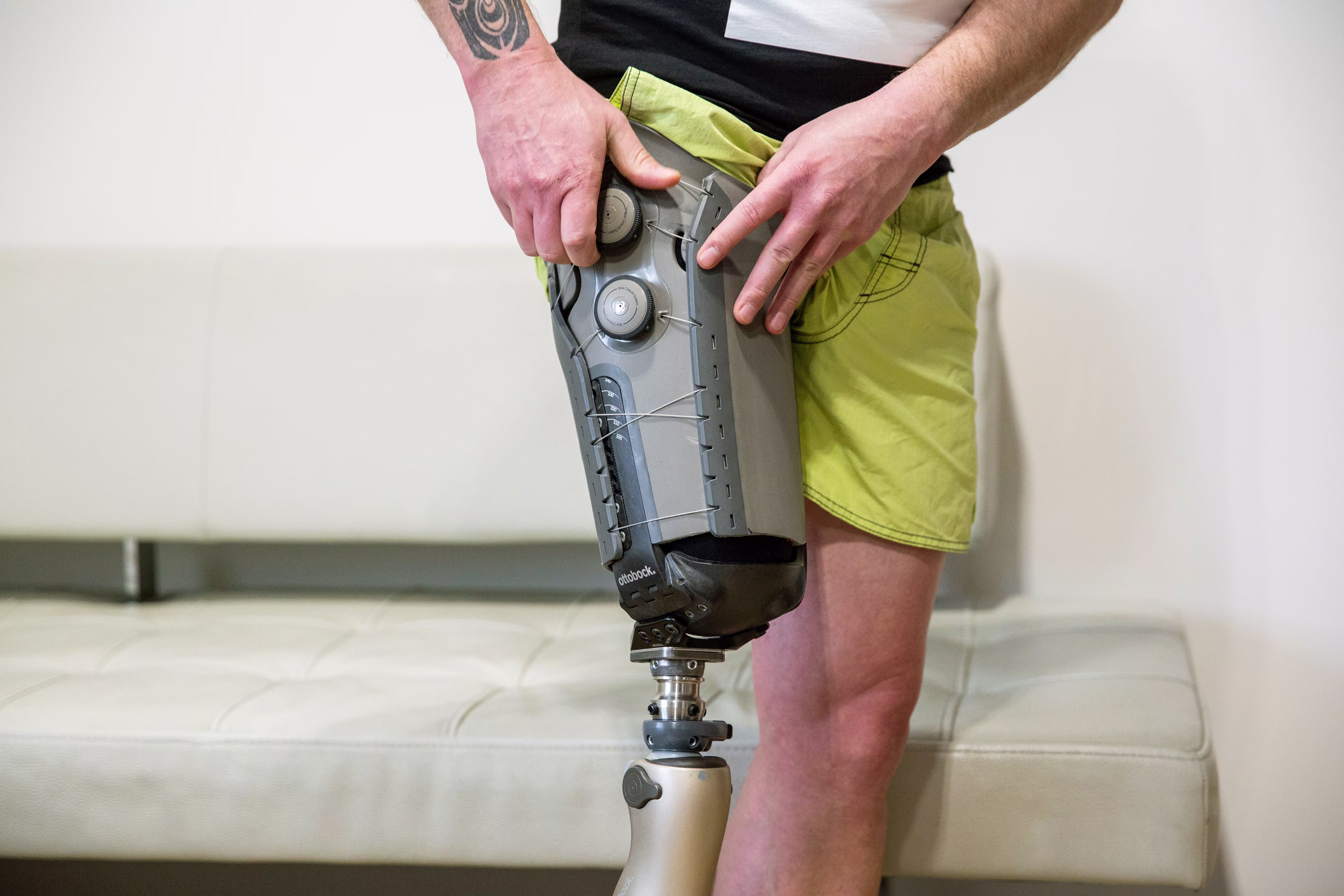 Varos Prosthetic Socket