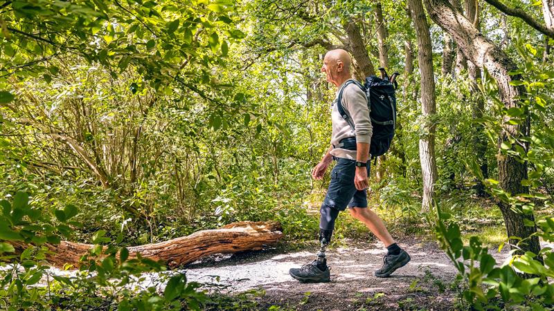Active man with a prosthetic leg hiking through a forest trail, wearing a backpack and enjoying nature on a sunny day.