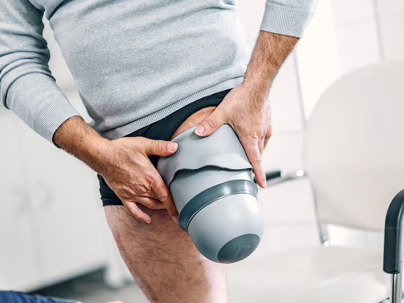 Amputee standing in front of a prosthetist and donning an Ottobock Skeo Sealing liner