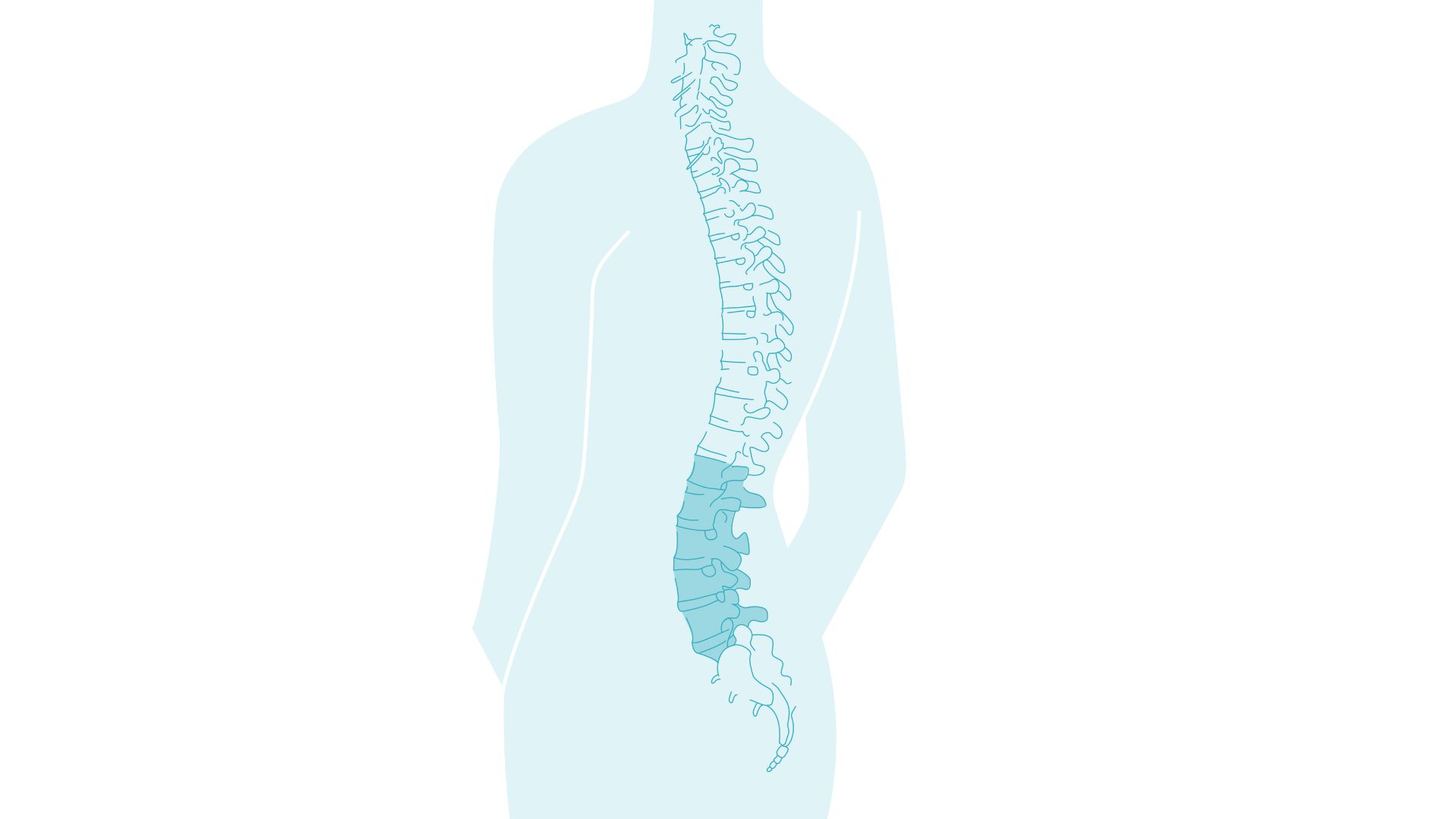 Spine marked in the area of the lumbar spine (lower back).