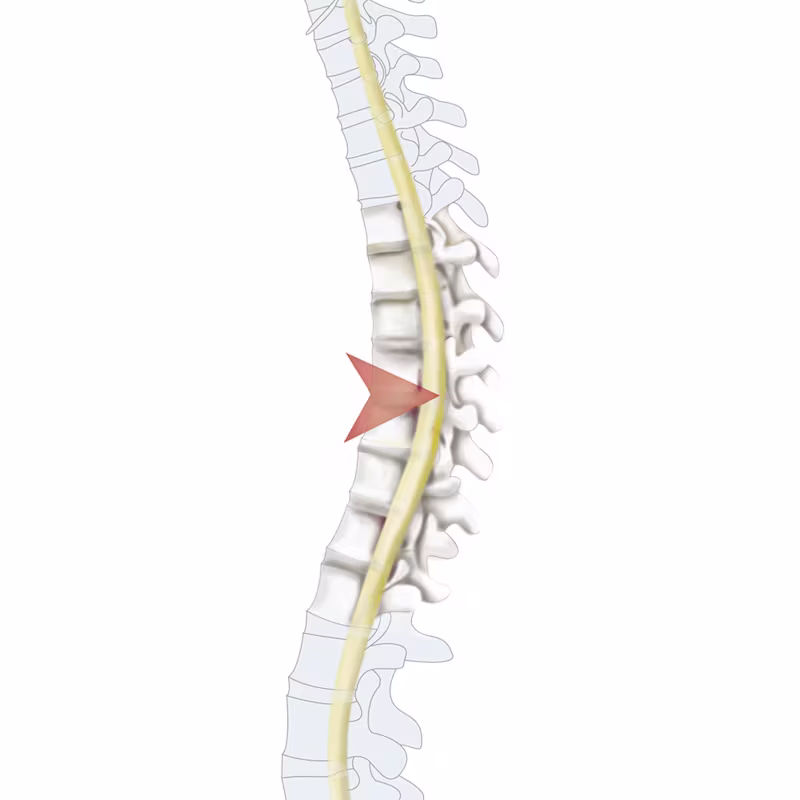 -35273 Querschn 11-4c wb(1443110) en