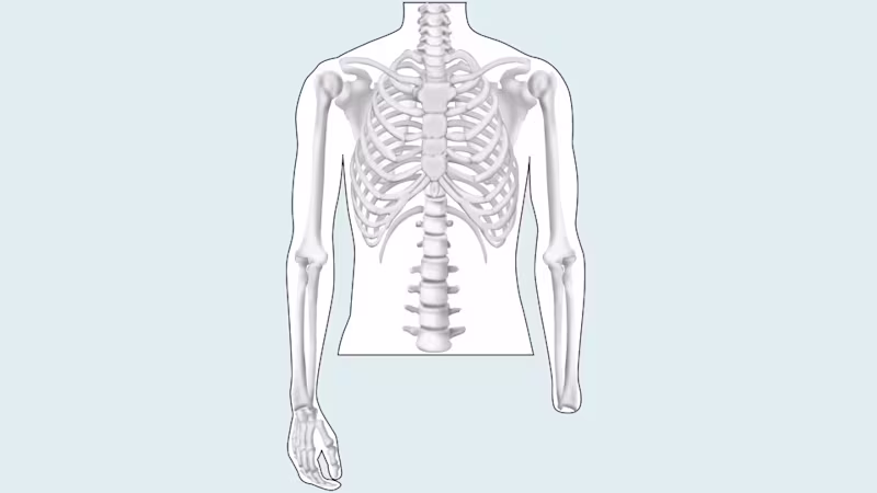 amputation level upper limb drawing 16 9 content-4