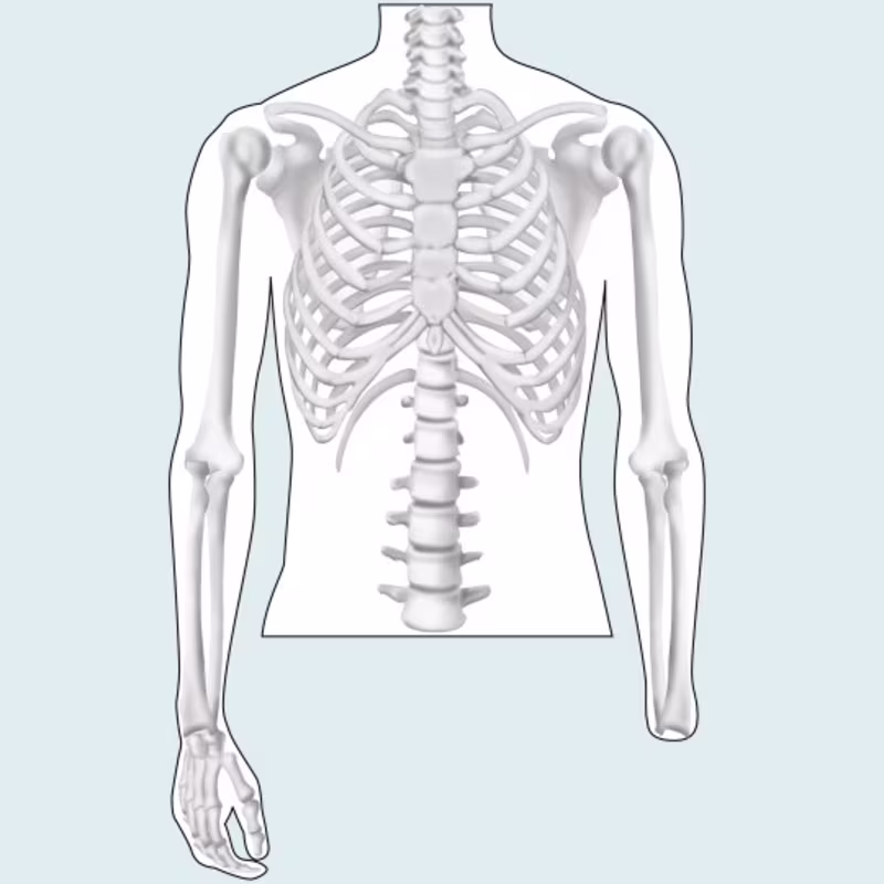 amputation level upper limb drawing 16 9 content-4