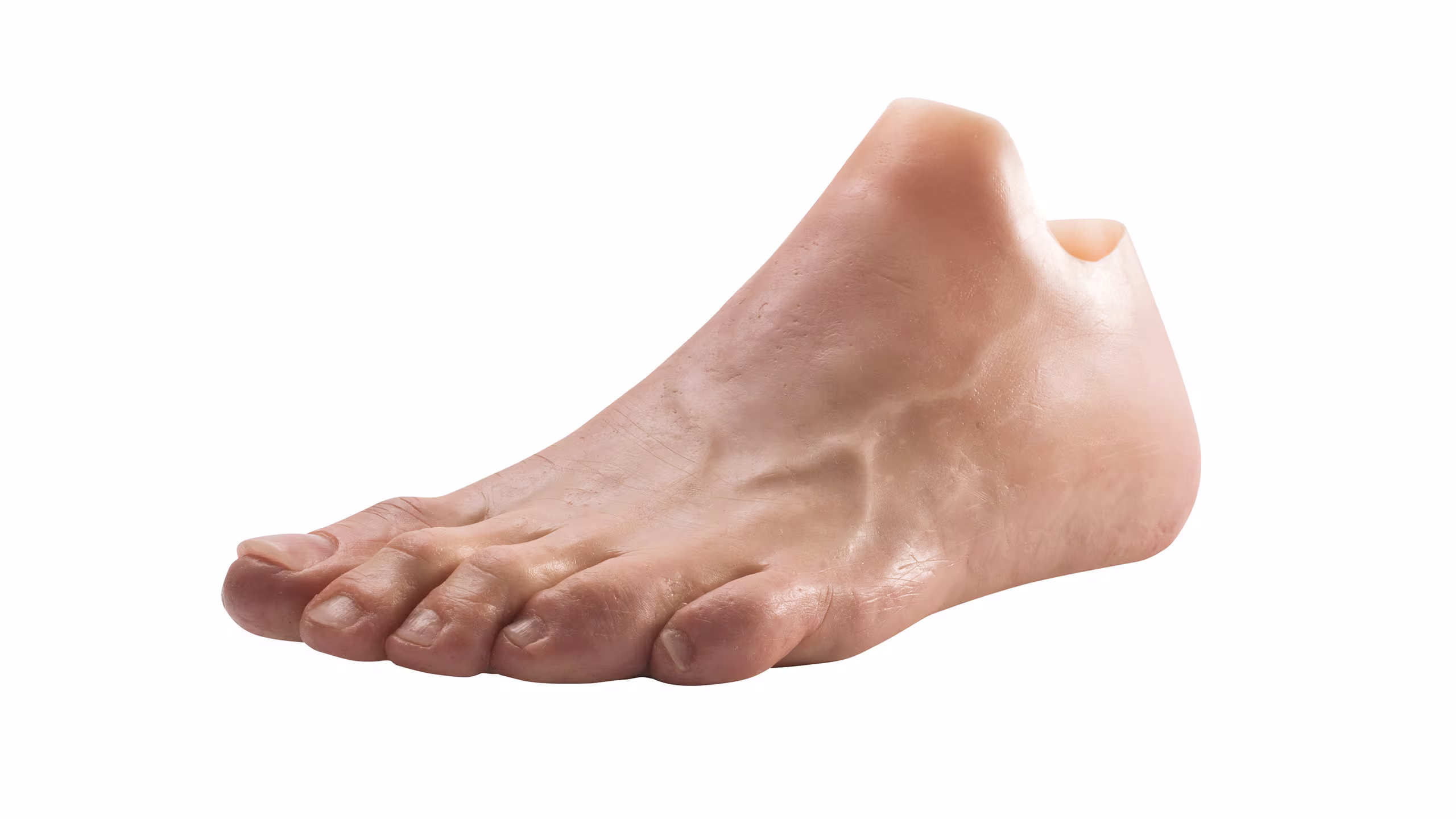 Protesi parziale di piede e avampiede in silicone