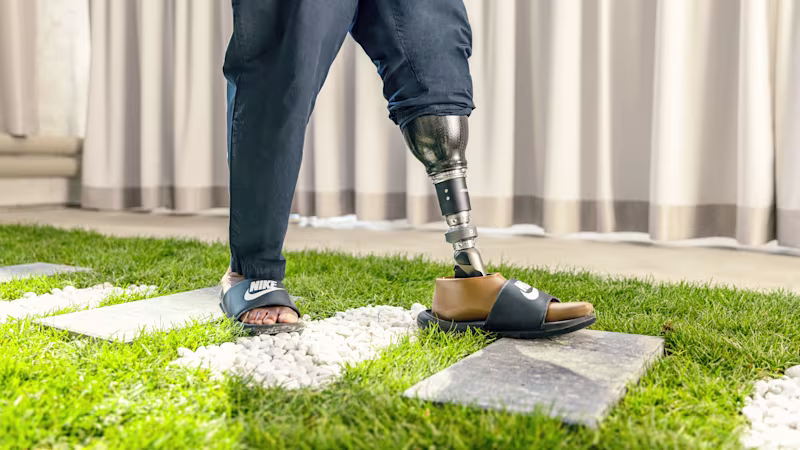 Person with Ottobock Taleo Adapt prosthetic foot wearing slippers and walking on grass, stone and pebble ground