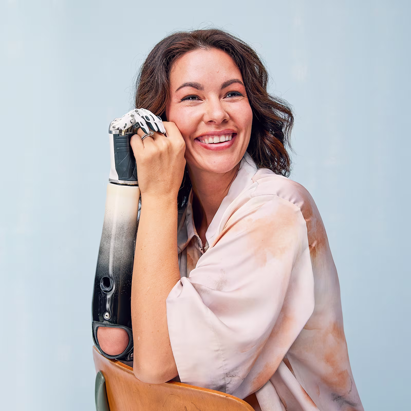 Close-up of a person with an upper limb prosthesis. The image illustrates the process of learning to use a prosthetic arm and adapting to everyday life with a prosthesis.