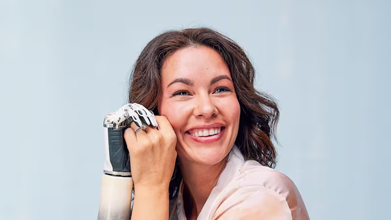 Close-up of a person with an upper limb prosthesis. The image illustrates the process of learning to use a prosthetic arm and adapting to everyday life with a prosthesis.