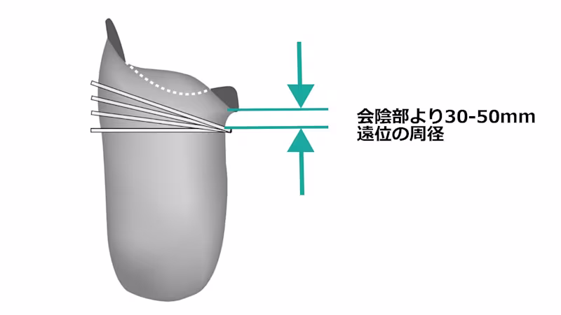 suspension 452a1 size_JA-JP